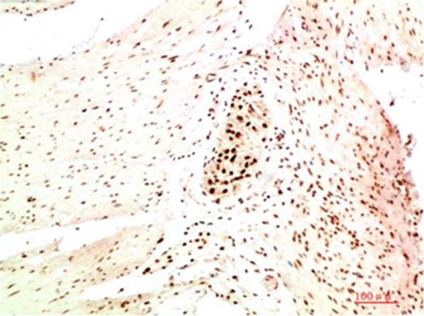 Anti-CBX5 Antibody (6Z70)