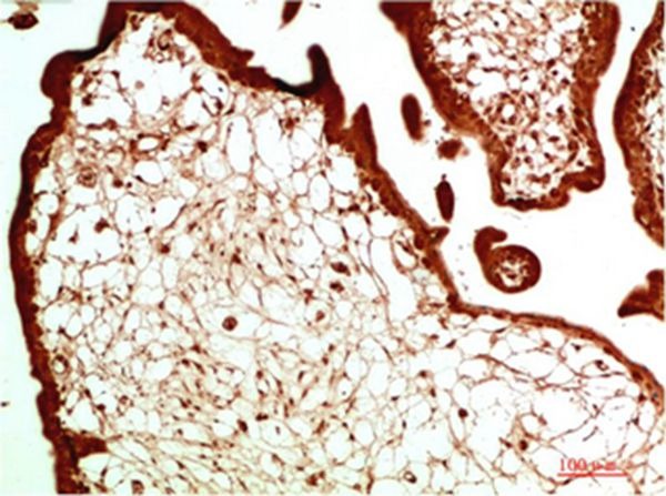 Anti-CBX5 Antibody (7S799)