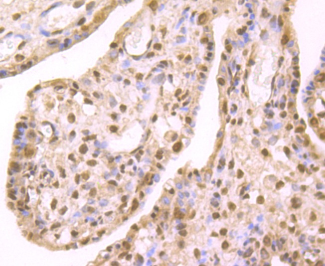 Anti-CBX3 Antibody (8Z290)