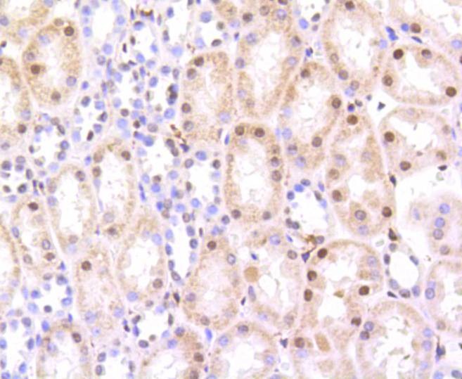Anti-HMGB1 Antibody (5H227)