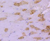 Anti-HSP20 Antibody (5R128)