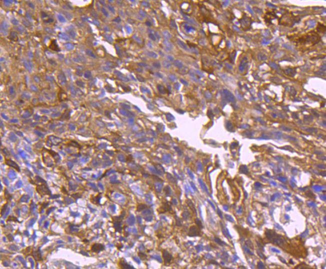 Anti-Hsp27/HSPB1 Antibody (5Q970)