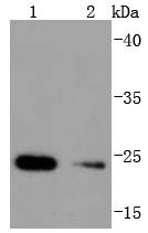 Anti-HSPB8 Antibody (1K143)