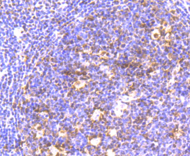 Anti-CBX3 Antibody (8Z290)