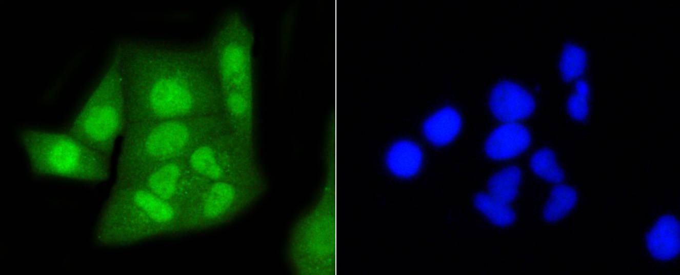 Anti-CBX5 Antibody (5G758)