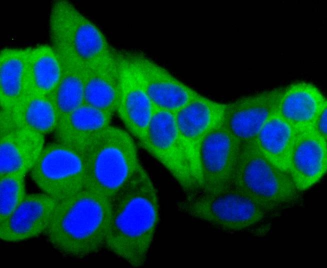 Anti-Hsp27/HSPB1 Antibody (5Q970)