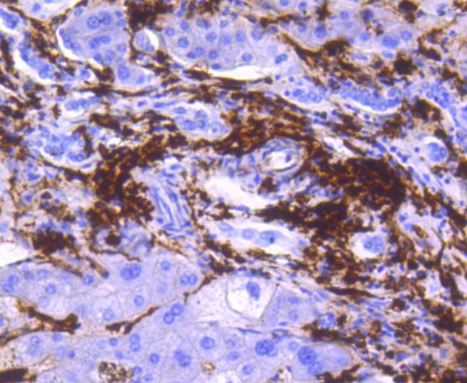 Anti-HLA-DRA Antibody (9X138)