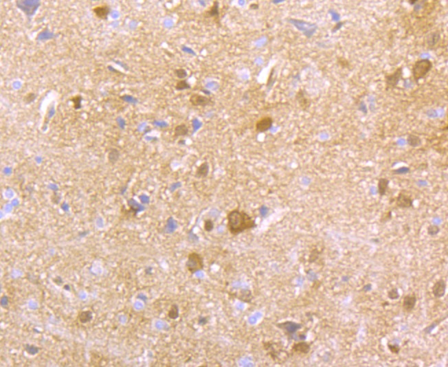 Anti-HGPRT Antibody (2V553)