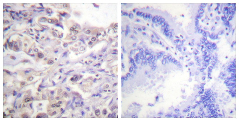 Anti-Phospho-HNRPD (Ser83) Polyclonal Antibody