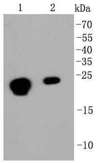 Anti-CBX5 Antibody (5G758)