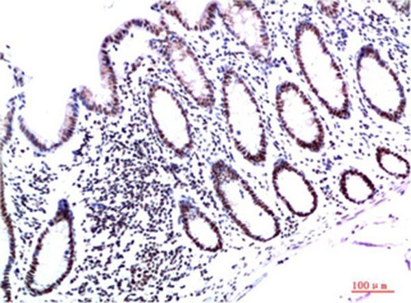 Anti-CBX3 Antibody (5C615)