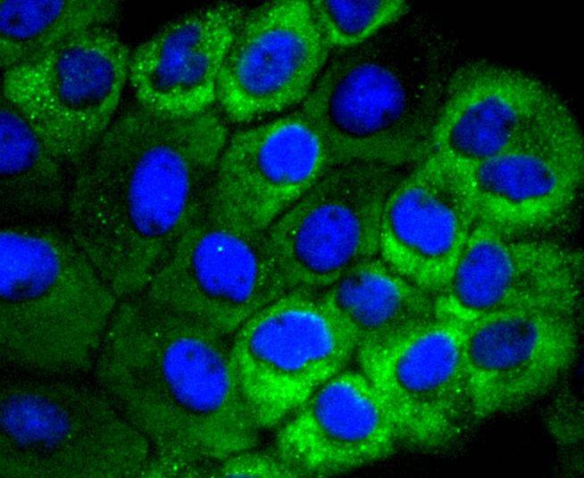 Anti-HSPB8 Antibody (1K143)