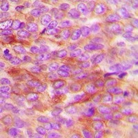 Anti-Phospho-HSP20 (Ser16) Polyclonal Antibody