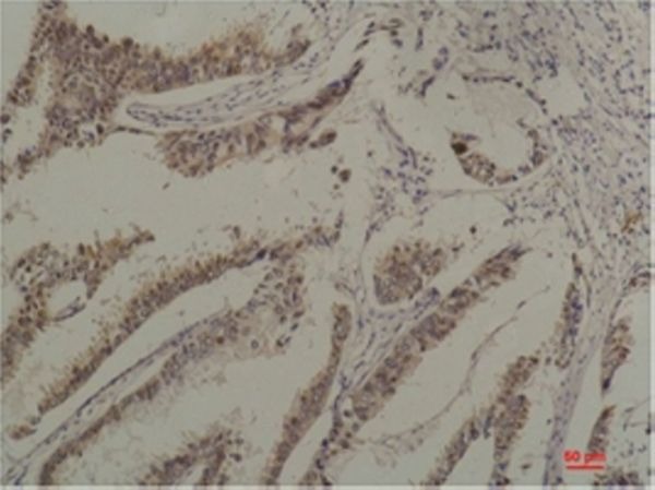 Anti-HSPA8 Antibody (7U331)