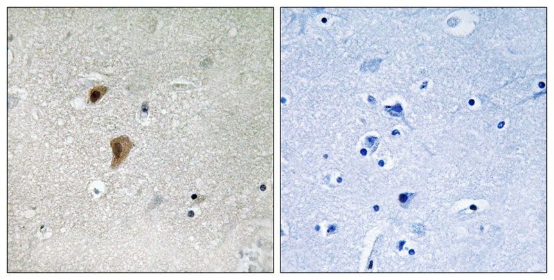 Anti-Phospho-HSF1 (Thr142) Polyclonal Antibody