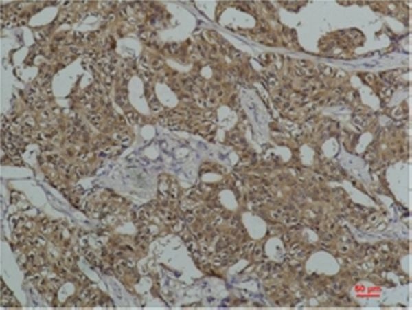 Anti-HSPA8 Antibody (9K547)