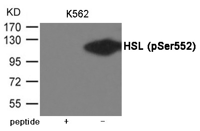 Anti-Phospho-HSL (Ser552) Polyclonal Antibody