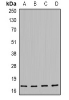 Anti-Phospho-HSP20 (Ser16) Polyclonal Antibody