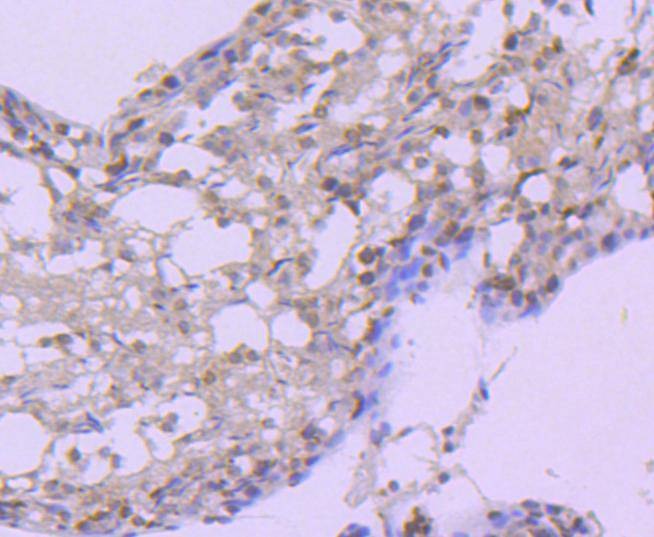 Anti-HSP105 Antibody (2M617)