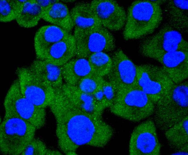 Anti-HSP105 Antibody (2M617)