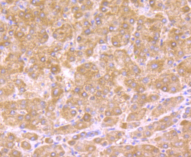 Anti-HSD11B1 Antibody (6B221)