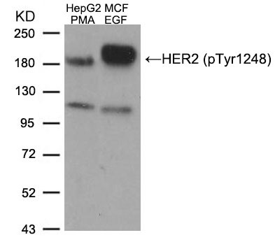Anti-Phospho-HER2/ERBB2 (Tyr1248) Polyclonal Antibody 2