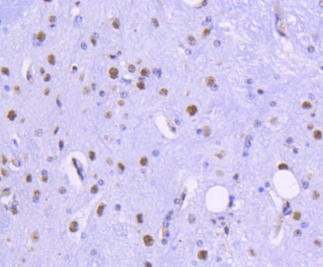 Anti-HDAC2 Antibody (5E9)