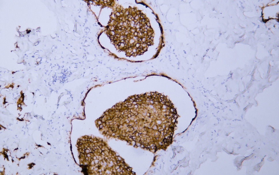 Anti-HER2/ERBB2 Antibody (8K444)