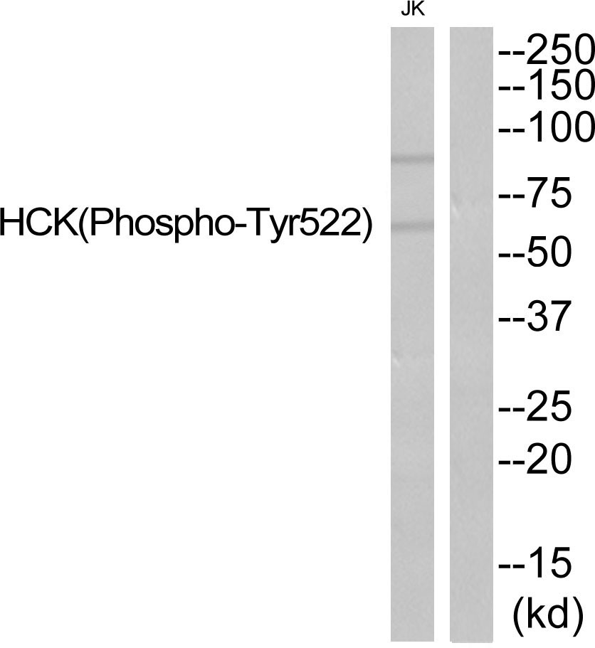 Anti-Phospho-HCK (Tyr522) Polyclonal Antibody