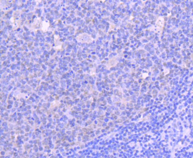 Anti-HDAC1 Antibody (3Z320)