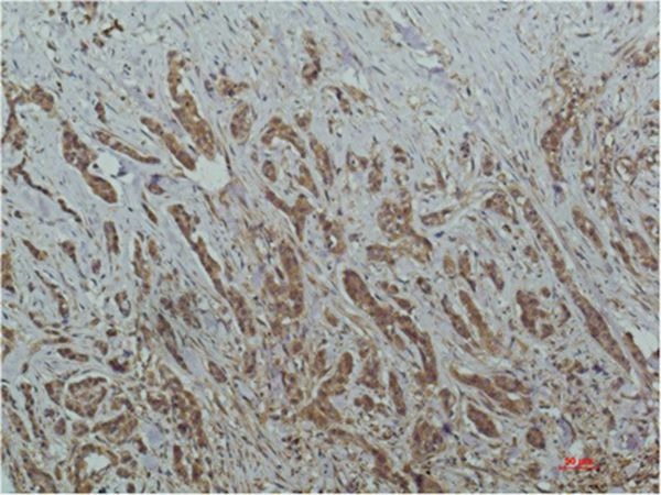 Anti-HDAC1 Antibody (6F688)