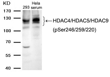 Anti-Phospho-HDAC4/5/9 (Ser246/259/220) Polyclonal Antibody