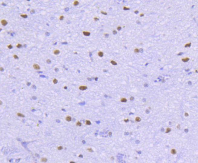 Anti-HDAC2 Antibody (5E9)