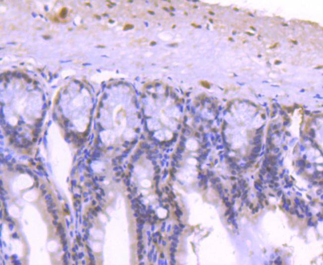 Anti-HDAC1 Antibody (3Z320)