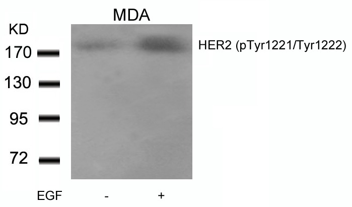 Anti-Phospho-HER2/ERBB2 (Tyr1221, 1222) Polyclonal Antibody 3