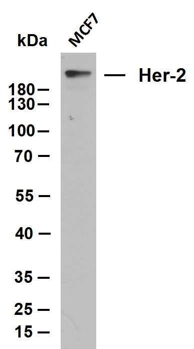 Anti-HER2/ERBB2 Antibody (8K444)