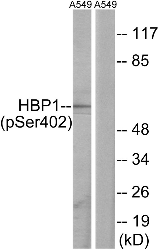 Anti-Phospho-HBP1 (Ser402) Polyclonal Antibody