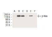 Anti-Phospho-HER2/ERBB2 (Thr 686) Antibody (1M462)