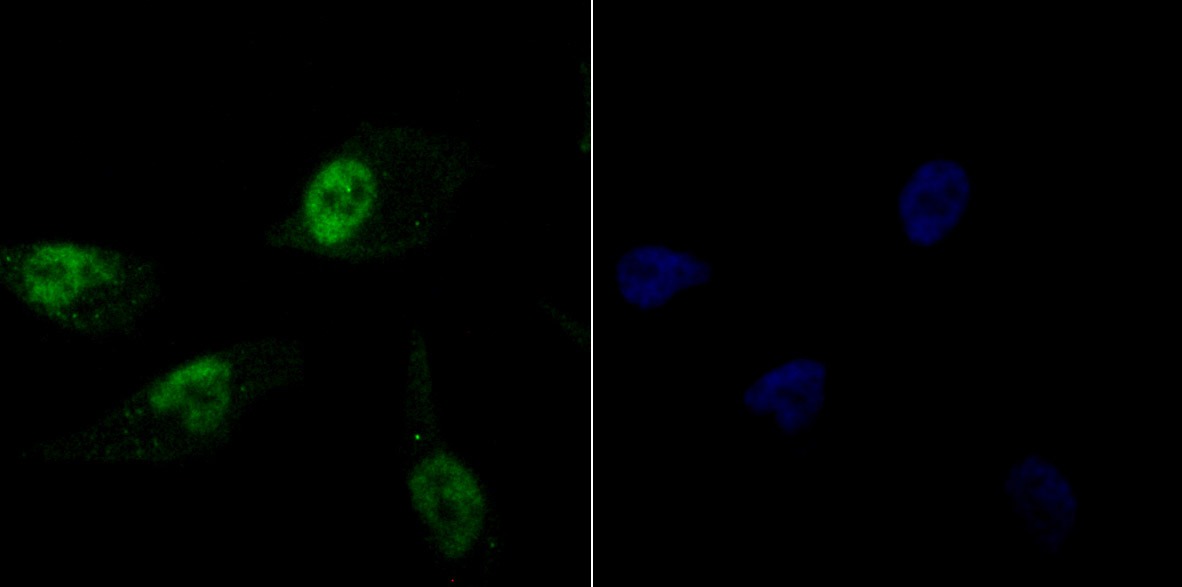 Anti-HIST1H1C Antibody (3S922)