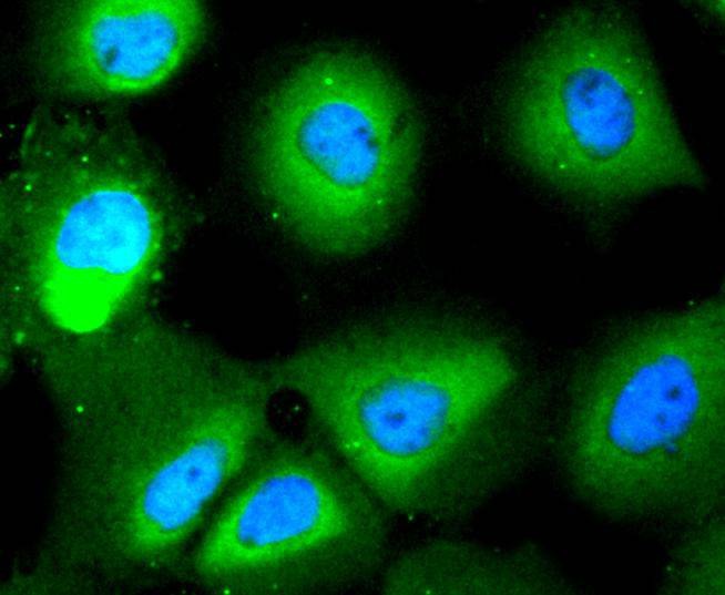 Anti-HDAC10 Antibody (7E996)
