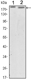 Anti-HER2/ERBB2 Antibody (2P27)