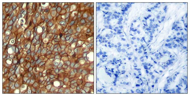 Anti-Phospho-HER2/ERBB2 (Tyr1248) Polyclonal Antibody 2