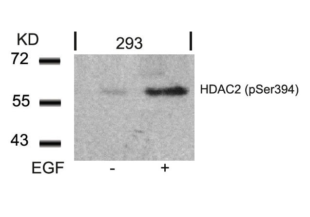 Anti-Phospho-HDAC2 (Ser394) Polyclonal Antibody
