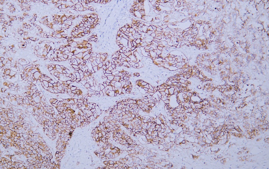 Anti-HER2/ERBB2 Antibody (8K444)