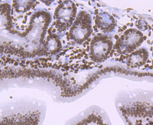 Anti-HIST1H1C Antibody (3S922)
