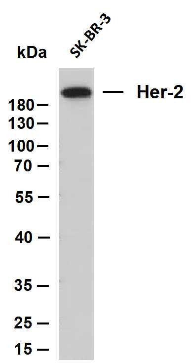 Anti-HER2/ERBB2 Antibody (8K444)