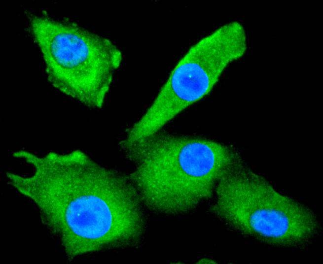 Anti-HDAC10 Antibody (7E996)