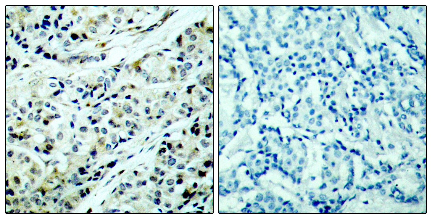 Anti-Phospho-HDAC5 (Ser498) Polyclonal Antibody