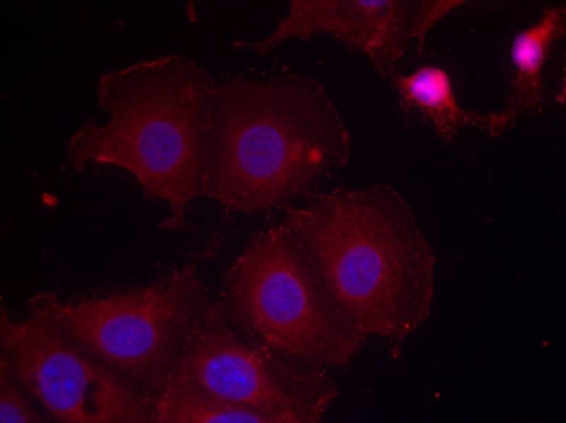 Anti-Phospho-HER2/ERBB2 (Tyr877) Polyclonal Antibody 2