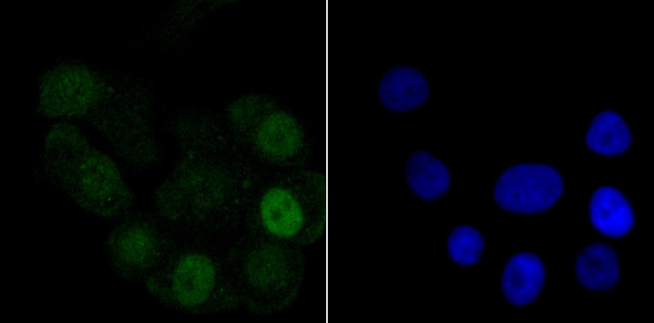 Anti-HIST1H1C Antibody (3S922)
